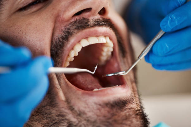 Best Emergency Dental Care for Broken or Chipped Teeth in White Island Shores, MA